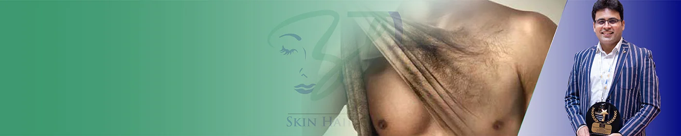 Best Body Hair Transplant in Gurgaon Delhi NCR
